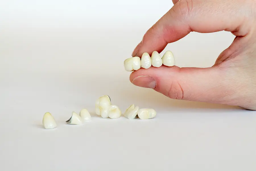 Restore Your Smile with Crowns and Bridges in Woodstock, GA