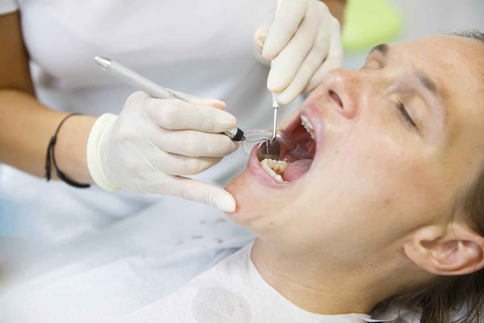Who Is a Good Candidate for Dental Implants?